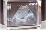 Schwangerschaftserinnerungen: Lasergravur