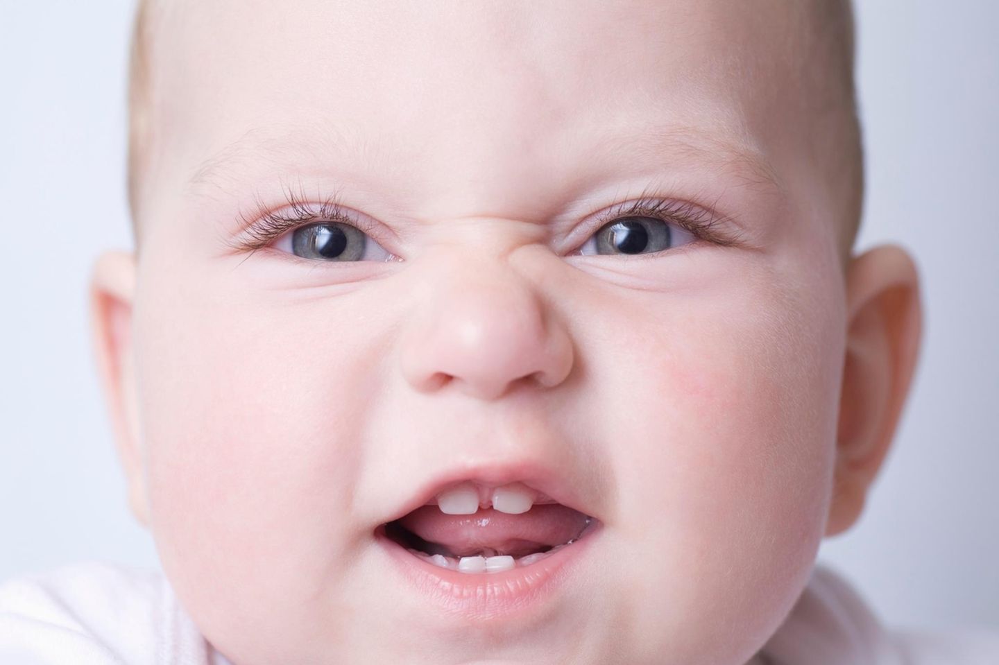 Baby mit "Hasenzähnen", jeweils nur die vorderen Schneidezähne