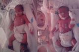 Dominic und Elias - acht Wochen zu früh geboren