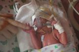 Lina Samira - 10 Wochen zu früh geboren