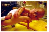 Lukas - 14 Wochen zu früh geboren