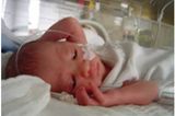 Jana - neun Wochen zu früh geboren