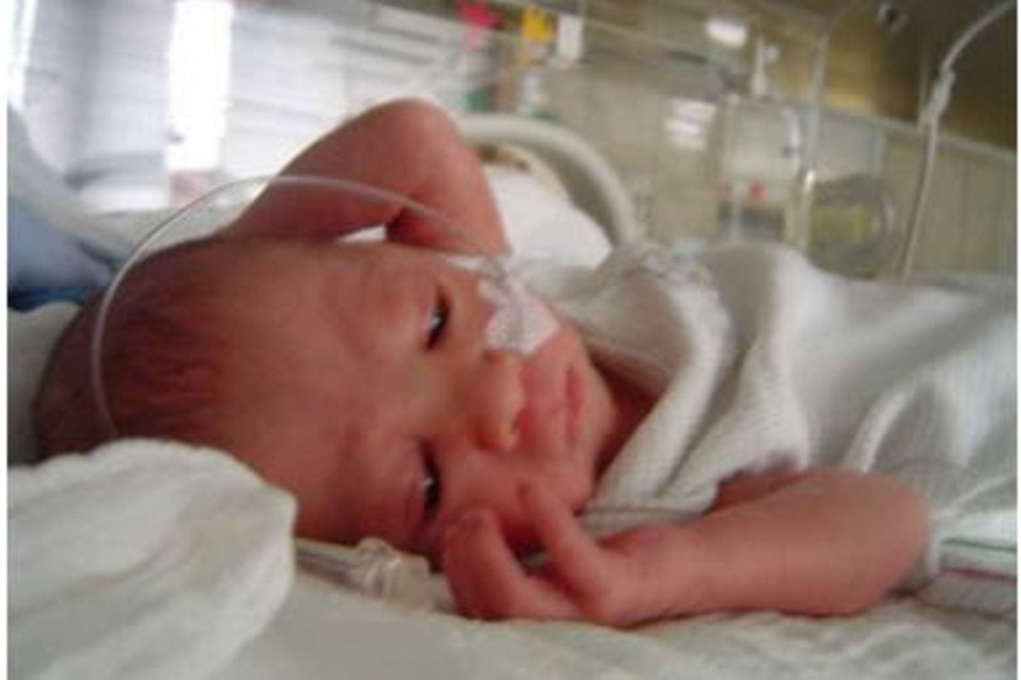 Jana - neun Wochen zu früh geboren