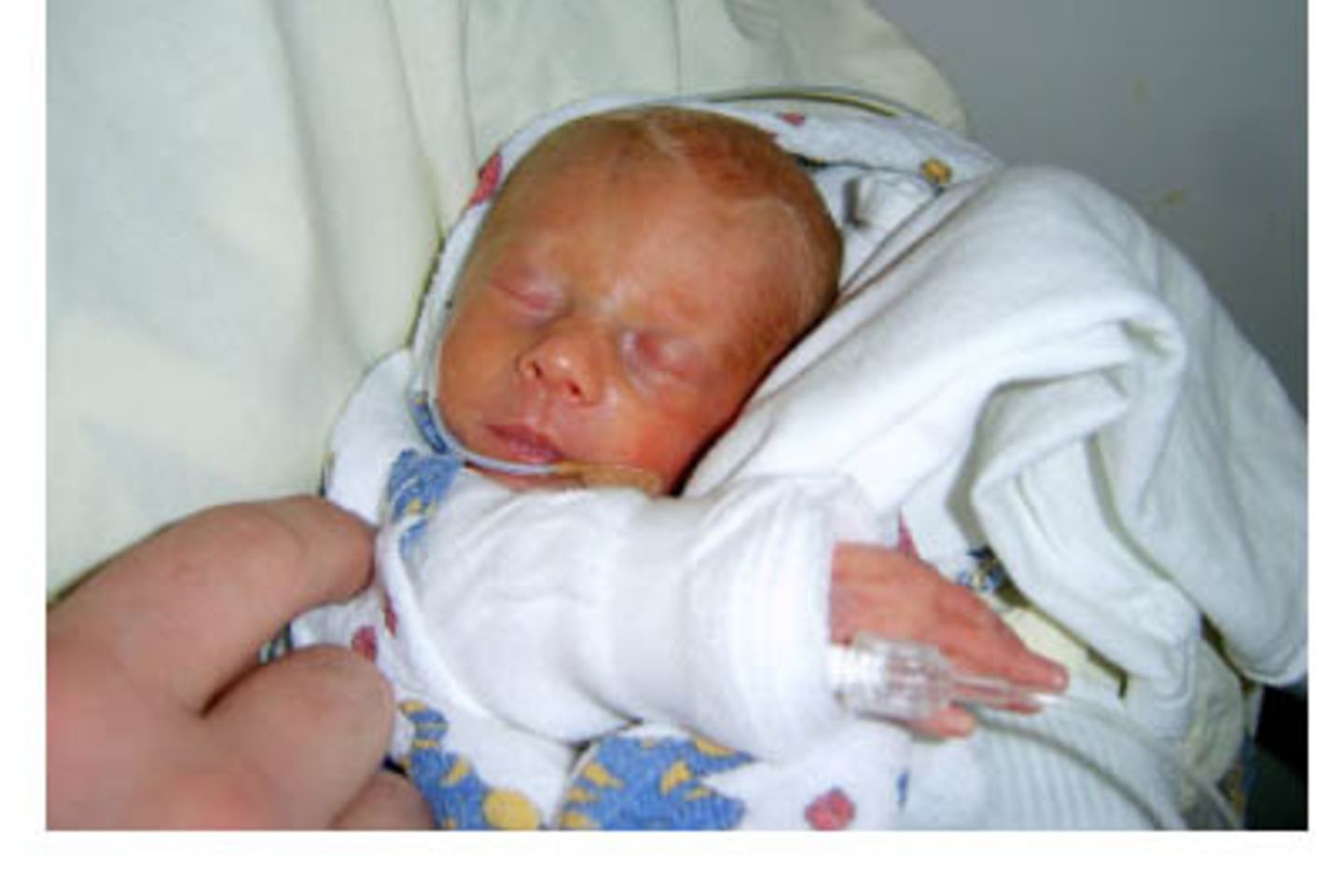 Amelie - 10 Wochen zu früh geboren