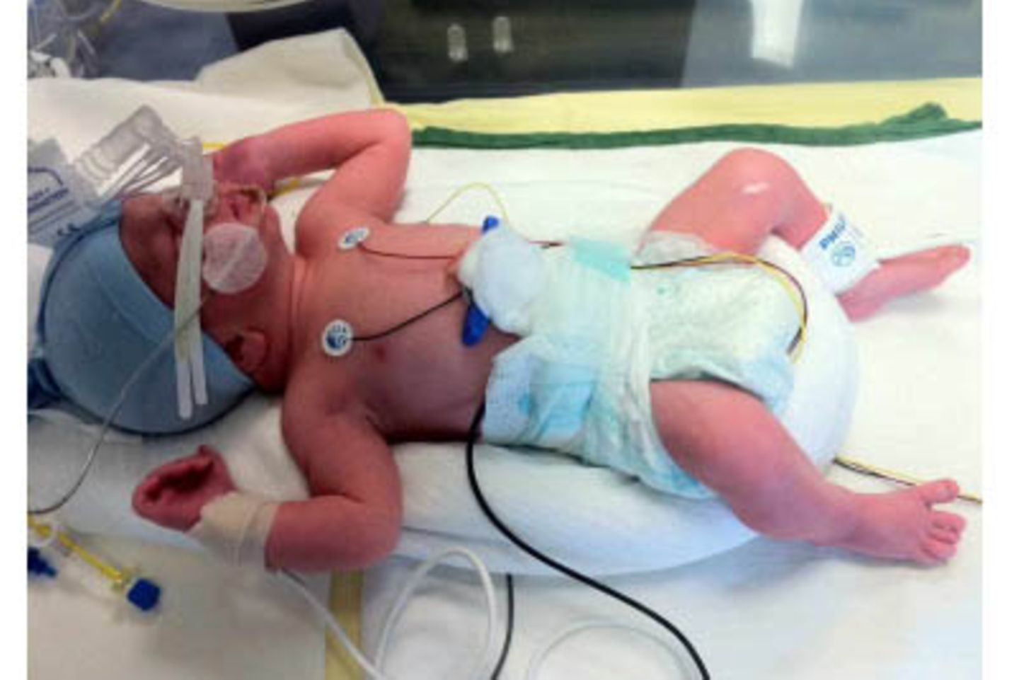 Luka - 6 Wochen zu früh geboren