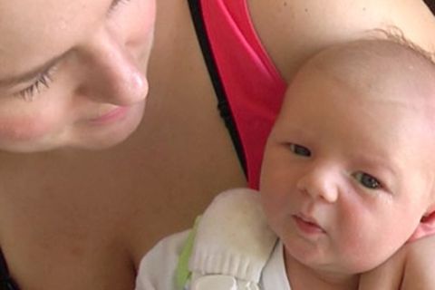 Hautprobleme beim Baby:  Neugeborenenakne: Was die Pickelchen bedeuten