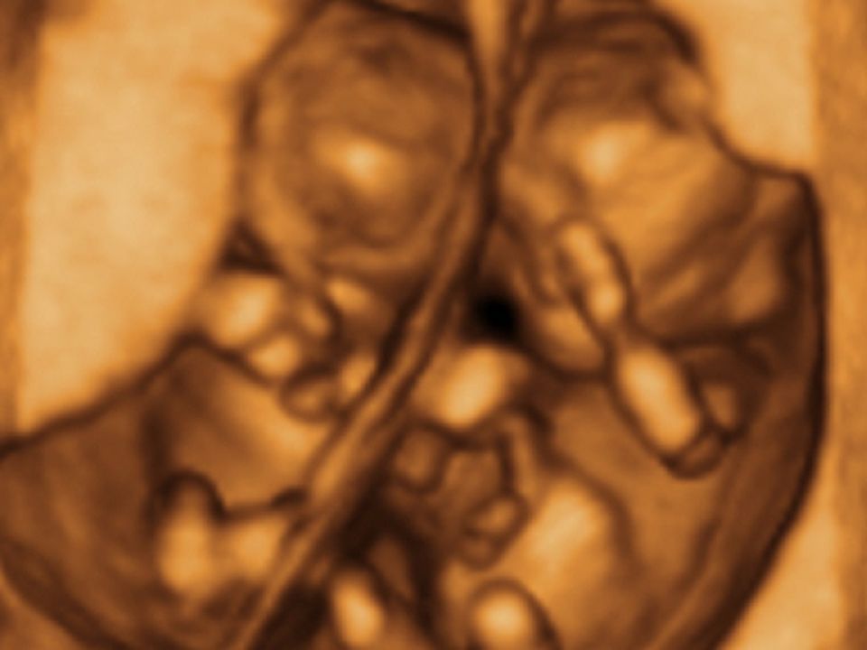 Schwangerschaftswoche ultraschall siebte 7. SSW