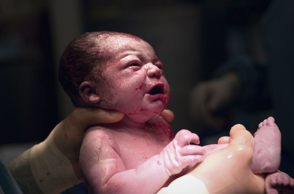 Kaiserschnittnarbe: Wie du die Narbe vom Kaiserschnitt nach der Geburt am besten behandelst