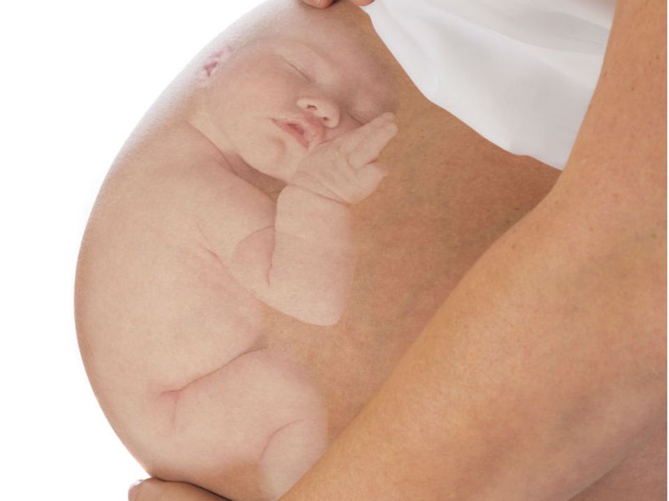 Beckenendlage: Äußere Wendung: Der richtige Dreh für eine normale Geburt