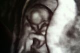 Ultraschallbild Baby: Unsere kleine Maja