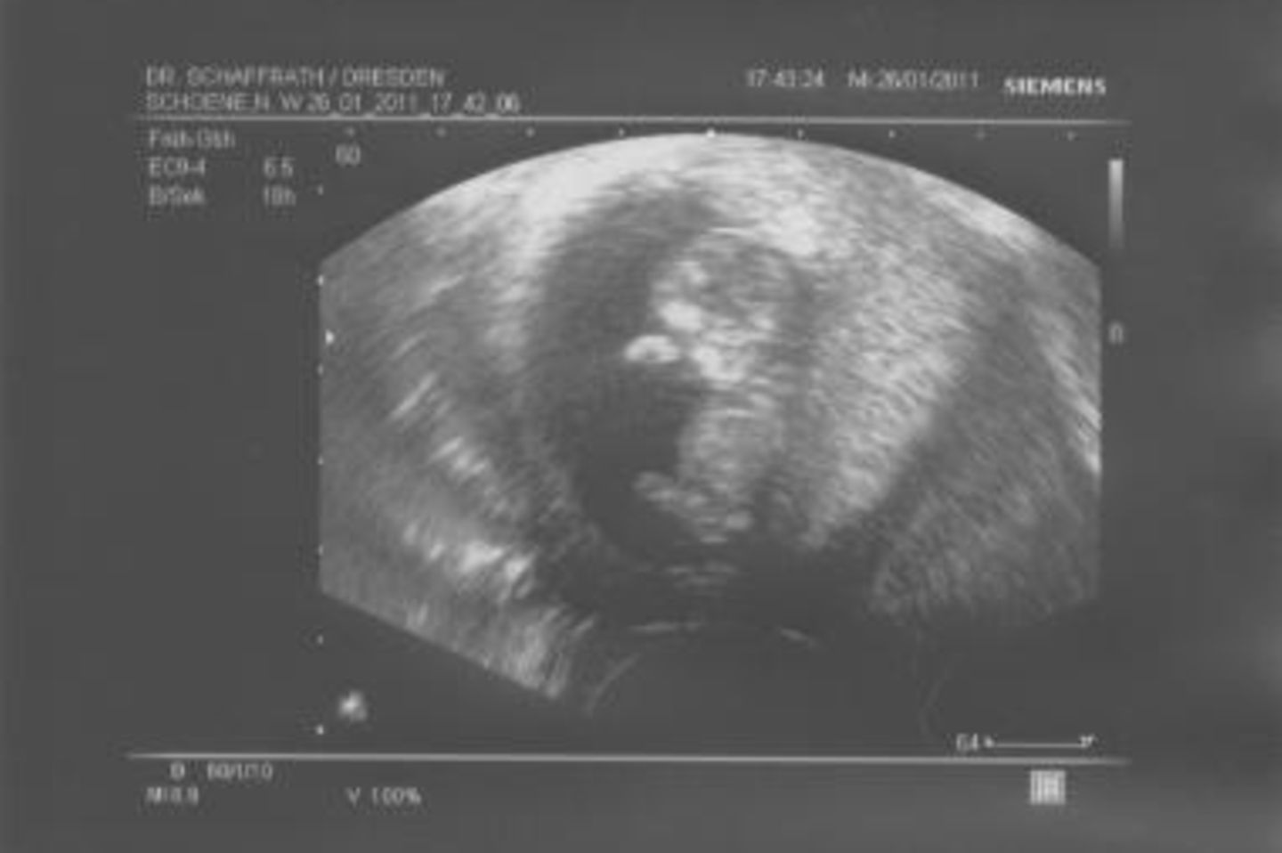 Ultraschallbild Baby: Hallo mein kleines Baby