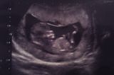 Ultraschallbild Baby: Lia in der 12. SSW