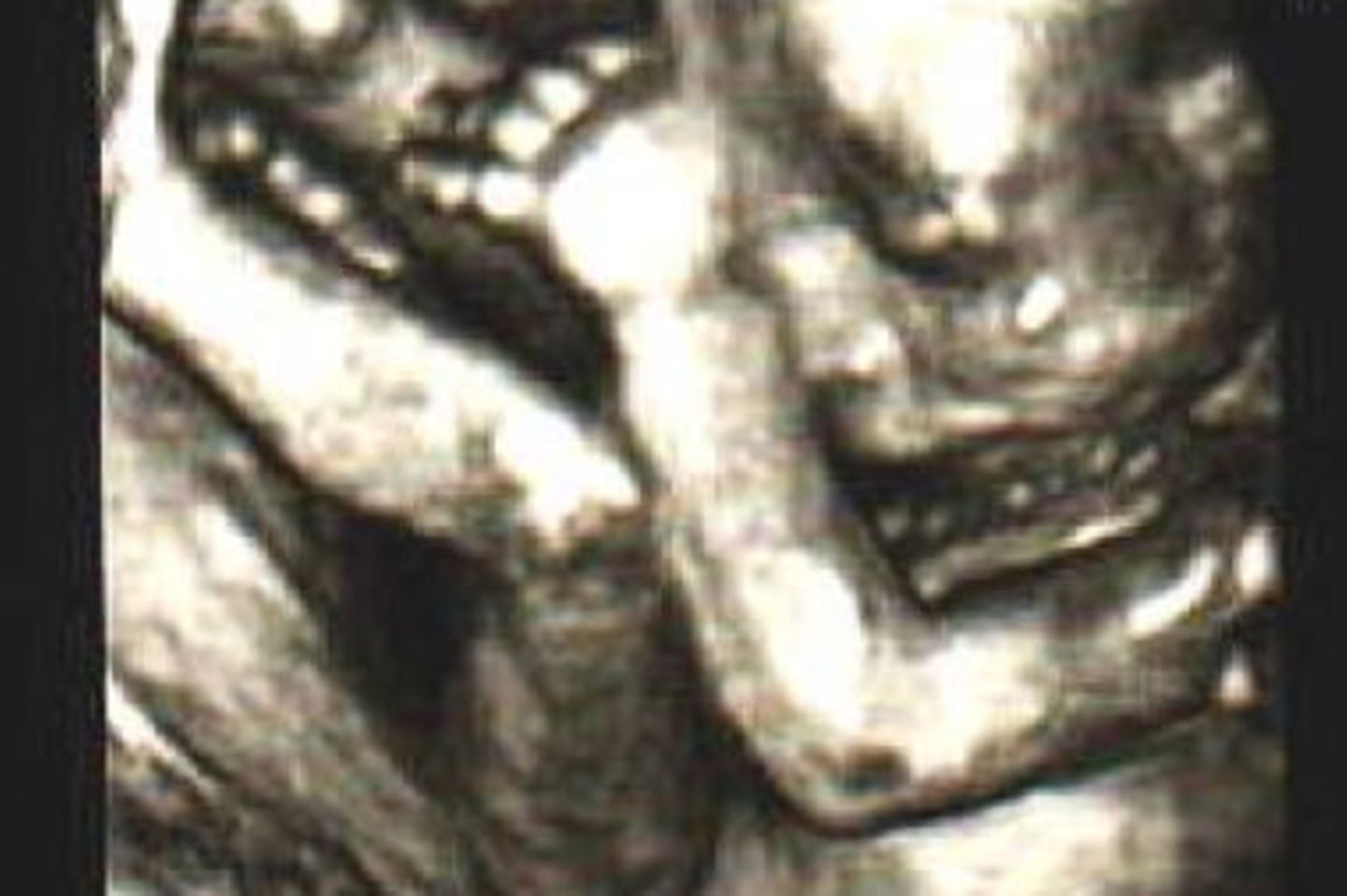 Ultraschall Baby