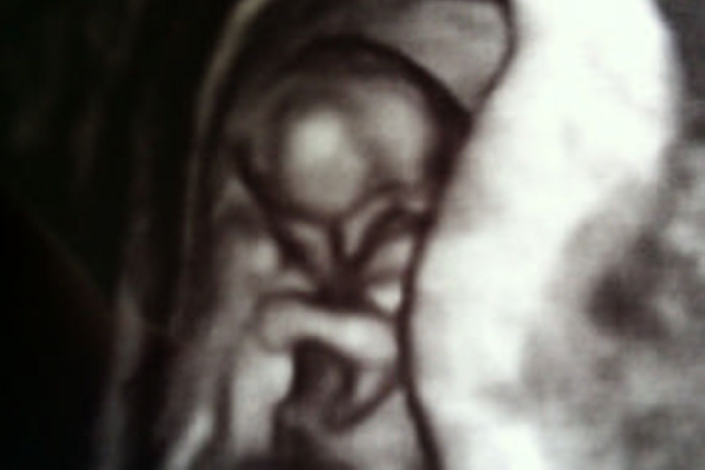 Ultraschallbild Baby: Hallo und winke winke