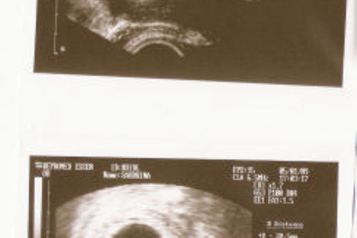 Ultraschallbilder Baby: Unsere Zwillinge