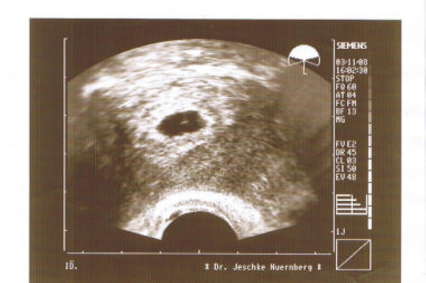 Ultraschallbild Baby: Bis jetzt ist nur ein Pünktchen