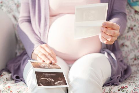 Schwangere Frau schaut auf Ultraschallbild
