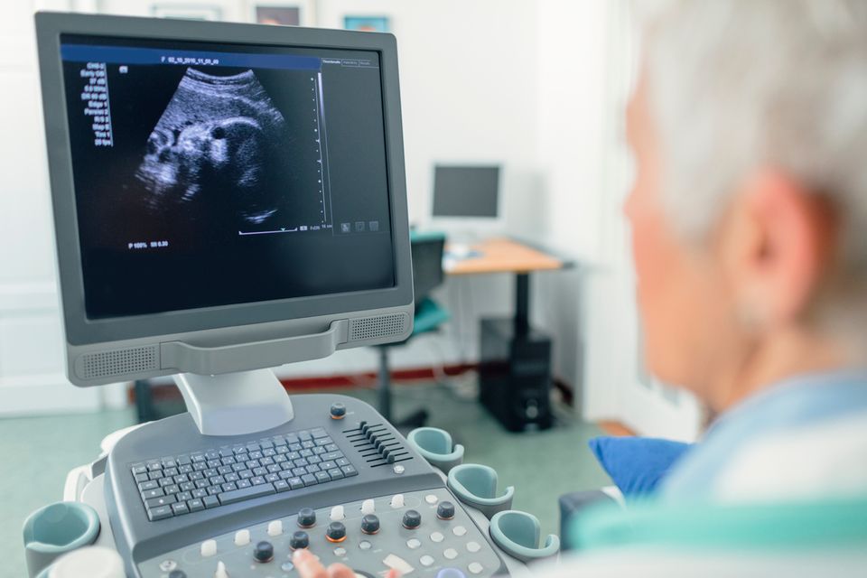Nackenfaltenmessung: Bildschirm bei einer Ultraschalluntersuchung