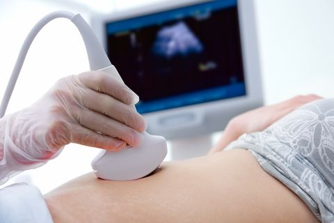 Schwanger trotz Spirale: Ultraschalluntersuchung