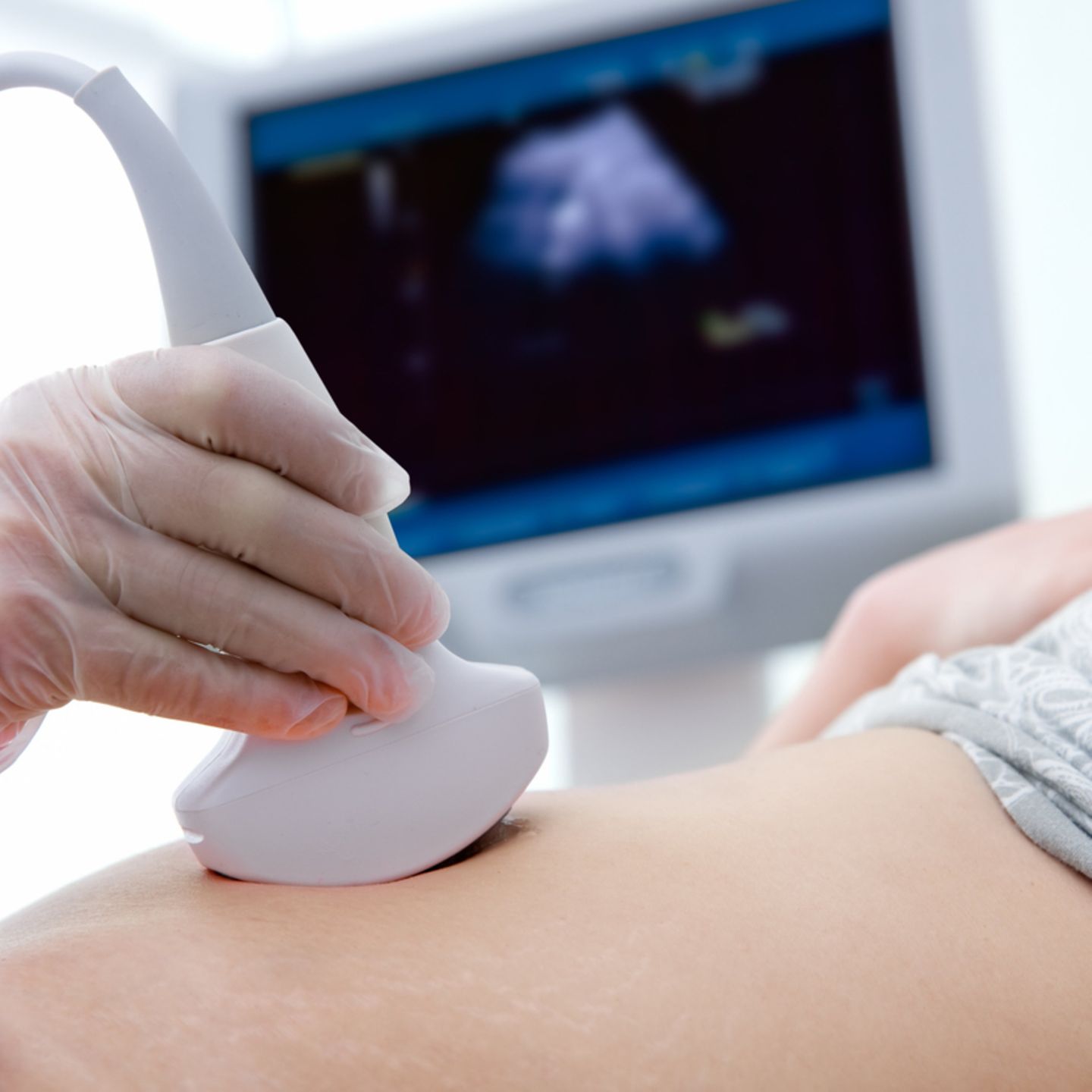 Vasektomie schwanger trotz Vasektomie: Das