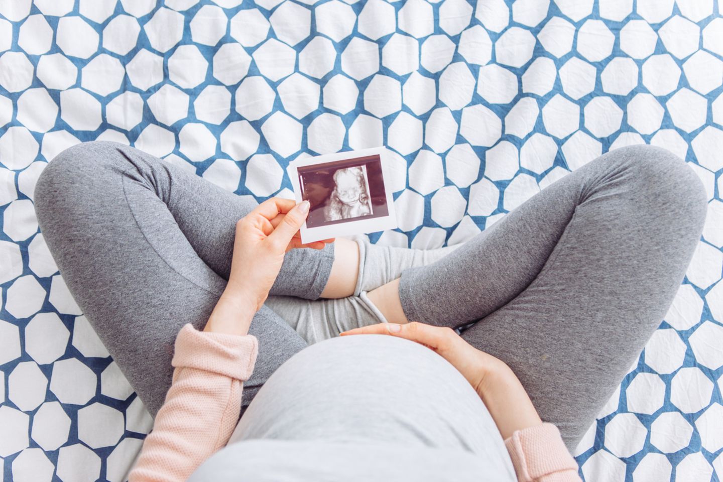 Schwangere sieht sich Ultraschallbild an