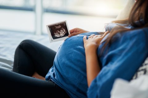 Schwangere guckt auf ein Ultraschallbild
