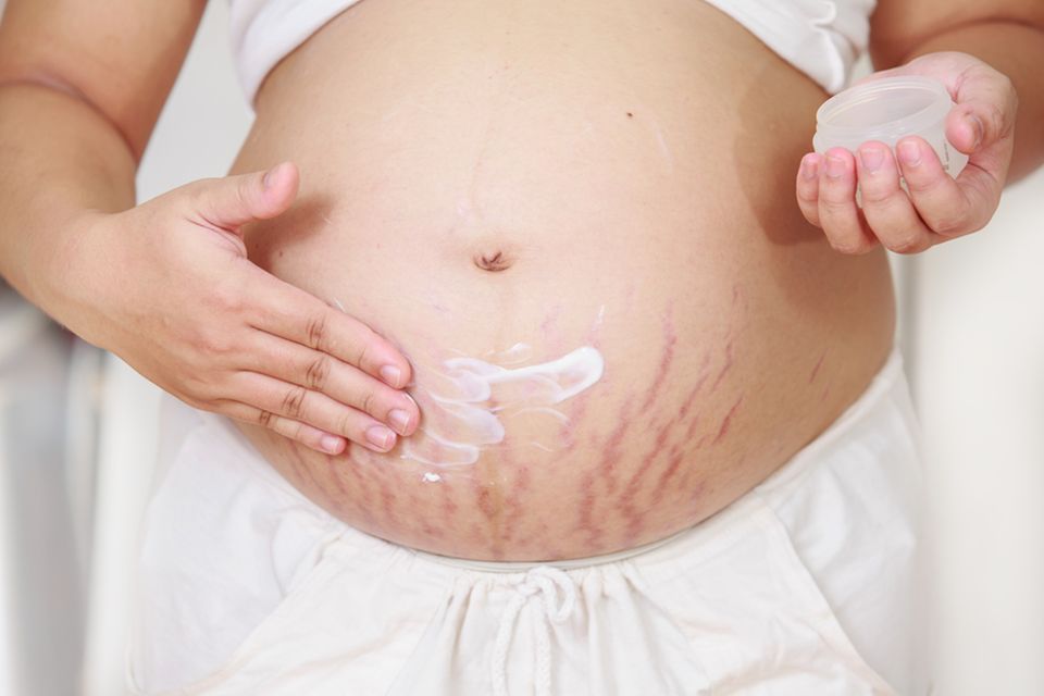 Schwangere leidet unter Schwangerschaftsstreifen und cremt sich den Bauch ein