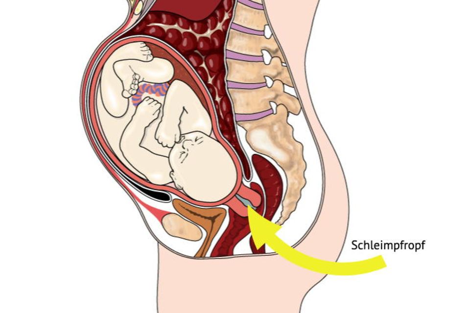Medizinische Grafik mit der Lage der Gebärmutter und des Schleimpfropfs