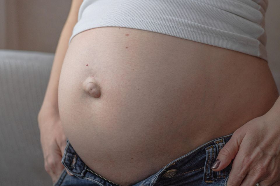 Bauch einer Schwangeren mit einem Nabelbruch