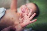 Kind mit Hand-Fuß-Mund-Krankheit zeigt seine Handfläche mit Ausschlag