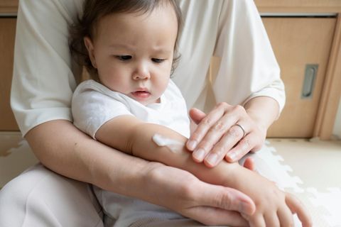 Neurodermitis Baby: Frau cremt Arm eines Babys ein