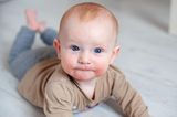 Niedliches rothaariges Baby mit Neurodermitis-Ausschlag im Gesicht