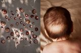Mutterschaft: Babykopf und Kastanien