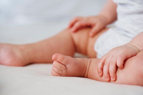 Trockene Haut Babys: Gereizte Haut an Armen und Beinen eines sitzenden Babys