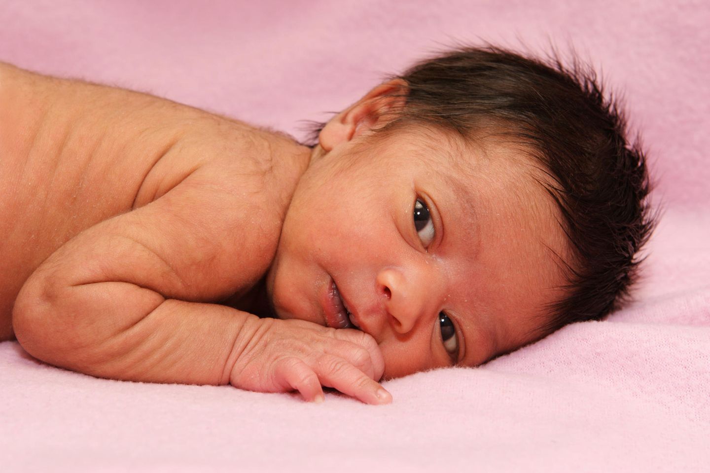 Lanugobehaarung: Ein Neugeborenes mit Haarflaum auf den Schultern