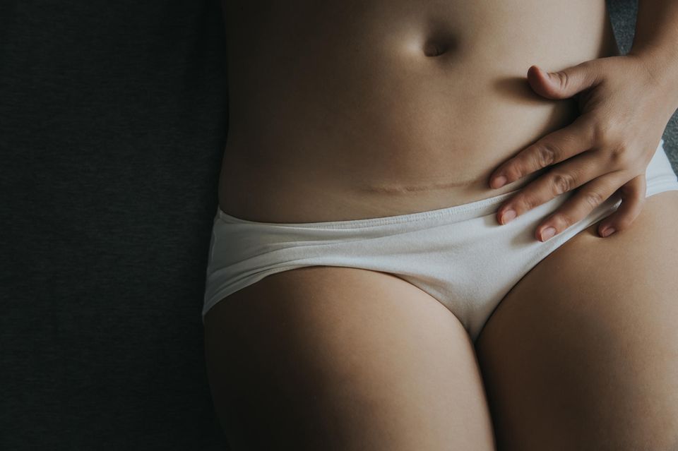 Kaiserschnitt-Erfahrung: Frau legt ihre Hand auf ihre Kaiserschnittnarbe