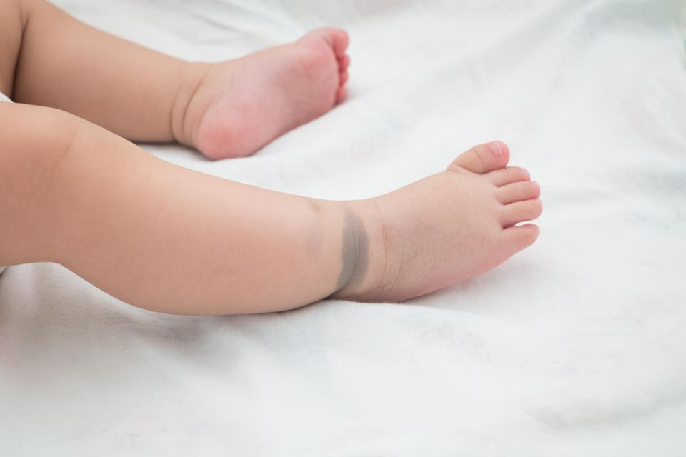 Mongolenfleck: Beine eines Babys mit bläulichen Muttermalen