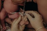 Eigenständige Geburt: Nablschnur wird durchtrennt
