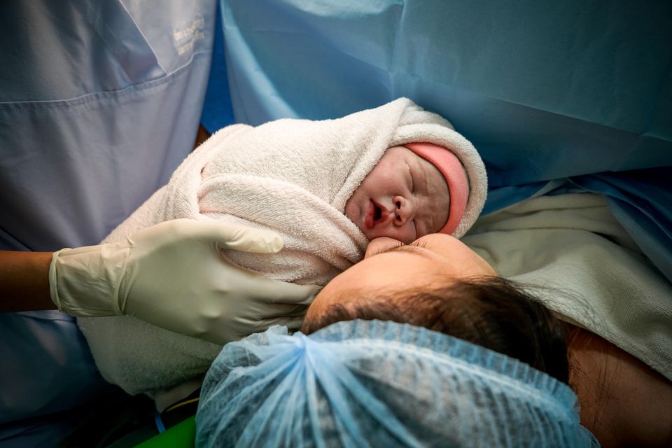 Kaiserschnitt: Neugeborenes wird seiner Mutter nach einem Kaiserschnitt gezeigt