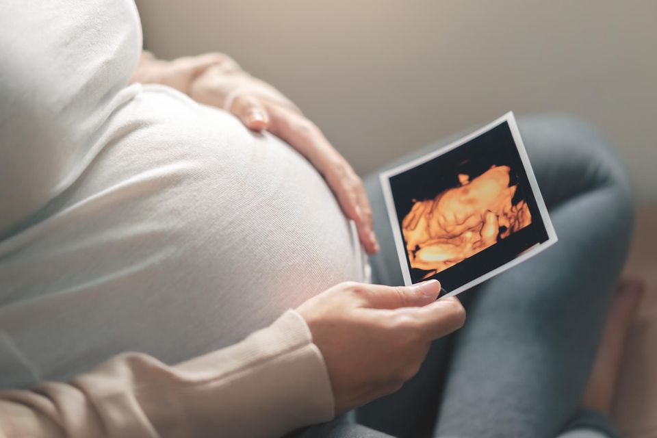 Nabelschnur um den Hals: Schwangere schaut auf ein 3-D-Ultraschallfoto eines Babys