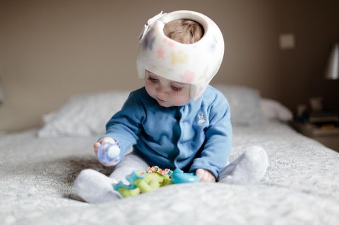 Helmtherapie für Babys: Baby mit Kopforthese sitzt auf einem Bett mit Schnuller in der Hand