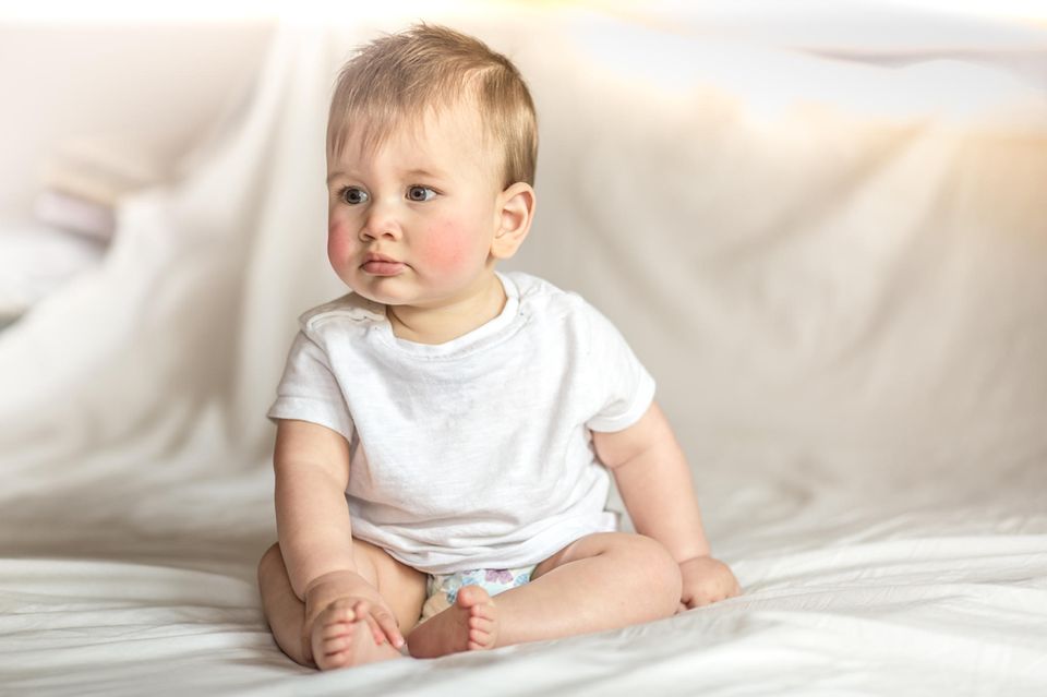 Allergien bei Babys: Kind mit Hautausschlag